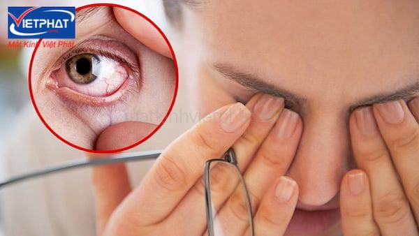9 triệu chứng bệnh về mắt nguy hiểm thường gặp 7 triệu chứng bệnh về mắt
