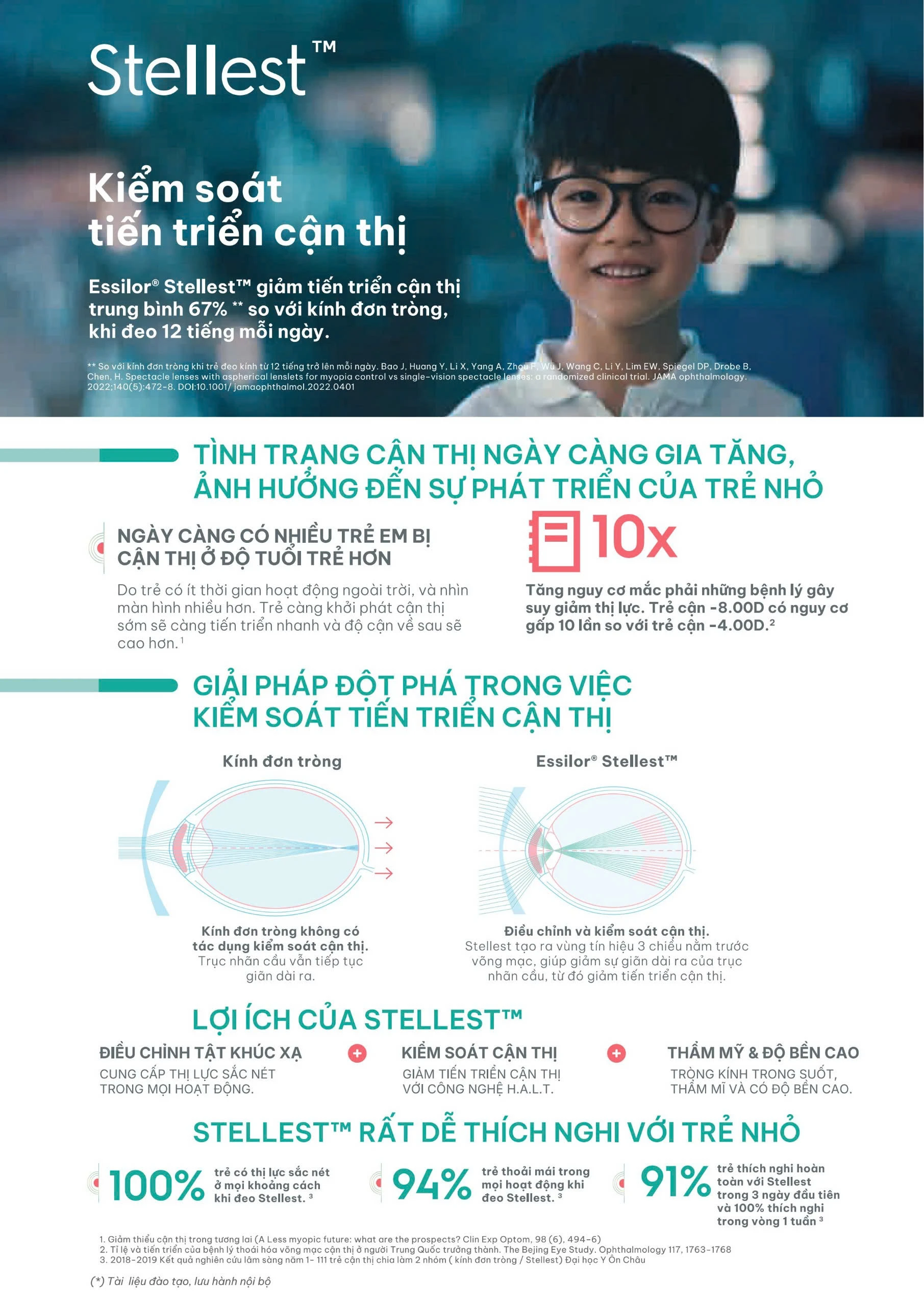 Tròng kính kiểm soát tiến triển cận thị Essilor Stellest 10 Tròng kính kiểm soát tiến triển cận thị Essilor Stellest