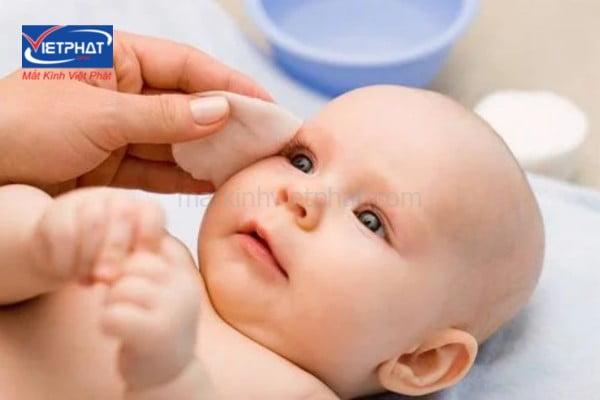 4 cách chữa mắt lác ở trẻ em tại nhà được các chuyên gia tư vấn 13 cách chữa mắt lác ở trẻ em tại nhà