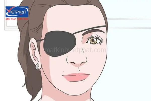4 cách chữa mắt lác ở trẻ em tại nhà được các chuyên gia tư vấn 10 cách chữa mắt lác ở trẻ em tại nhà