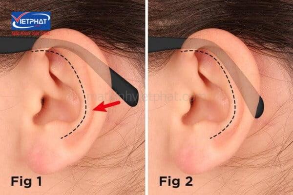 Cách đeo kính không bị đau tai - Nguyên nhân và cách khắc phục 7 đeo kính bị đau vành tai