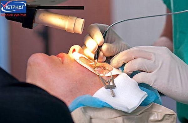 Cận nặng có mổ được không? 7 điều cần lưu ý trước khi mổ cận 7 Hình ảnh khi mổ cận thị