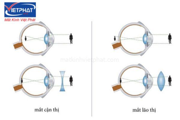 Kính lão có tác dụng gì? Có nên đeo kính lão thường xuyên? 9 kính lão có tác dụng gì