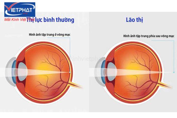 Kính lão là thấu kính gì? Mua kính lão thị ở đâu? 8 kính lão là thấu kính gì