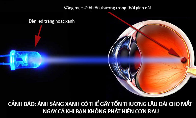 Tác hại của ánh sáng xanh
