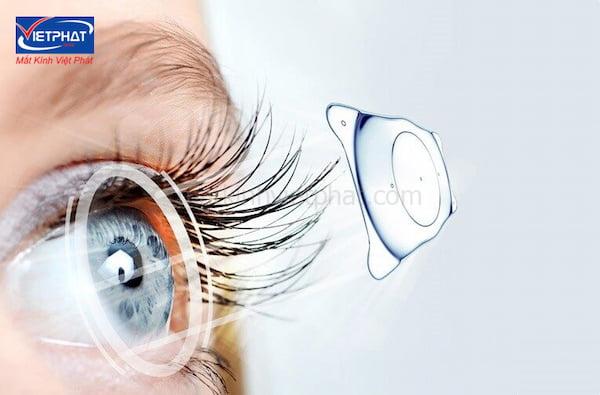 Cận loạn thị là gì? Cận loạn có mổ được không? 10 cận loạn có mổ được không