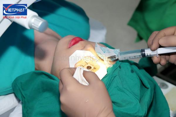 Cận loạn thị là gì? Cận loạn có mổ được không? 11 cận loạn có mổ được không