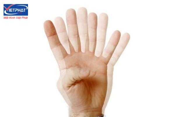 Loạn thị là gì? Nguyên nhân và cách khắc phục 15 bệnh loạn thị là gì