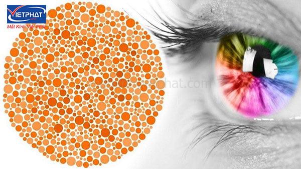 Bệnh mù màu là gì? Có chữa trị được không? 6 Hội chứng mù màu là gì?