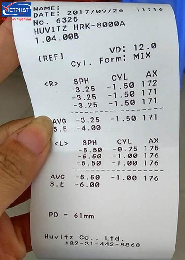 Cách đọc kết quả đo mắt chính xác 8 Tờ phiếu đo mắt tự động