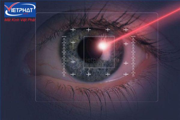 3 cách hạ nhãn áp phổ biến, hiệu quả nhất hiện nay 8 cách hạ nhãn áp
