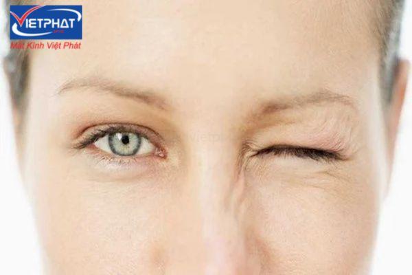 3 cách hạ nhãn áp phổ biến, hiệu quả nhất hiện nay 10 cách hạ nhãn áp