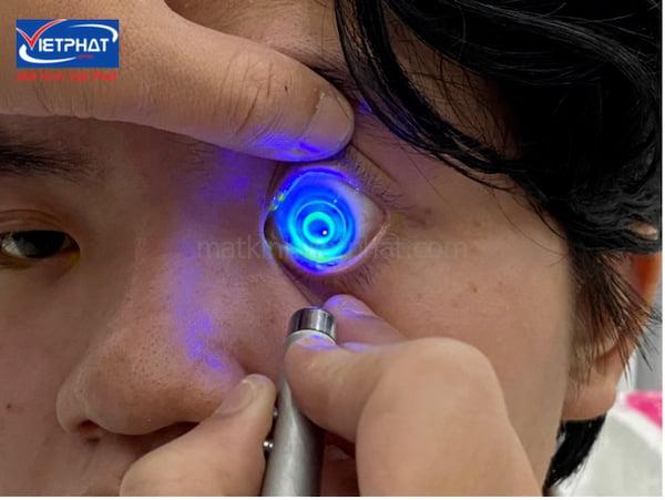 Cận thị có chữa được không? 6 phương pháp chữa cận thị tốt nhất 13 cận thị có chữa được không