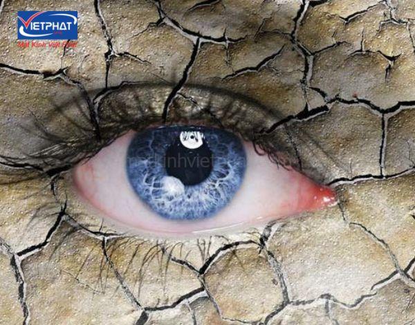7 Cách khắc phục đeo kính áp tròng bị cay mắt 10 đeo kính áp tròng bị cay mắt