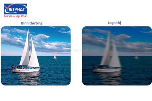 Loạn thị bao nhiêu độ là nặng? Bị loạn cao nhất là bao nhiêu độ? 10 bị loạn thị bao nhiêu độ là nặng