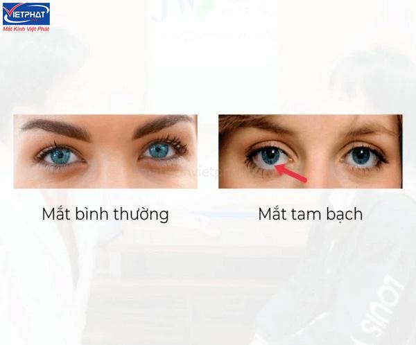 Mắt tam bạch là gì? Ý nghĩa tướng mắt tam bạch 9 Mắt thường và mắt tam bạch khác nhau như nào