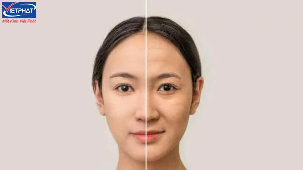 Mắt to mắt nhỏ là gì? Top 3 cách khắc phục mắt to mắt nhỏ tại nhà 11 Mắt to mắt nhỏ do quá trình lão hóa