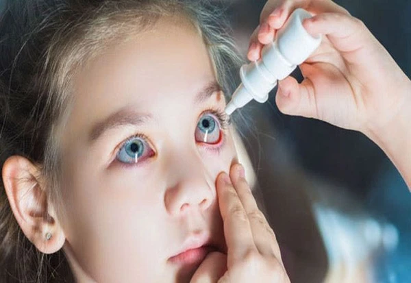 Ngứa Mắt Trái: Điềm Báo, Nguyên Nhân Và Cách Trị 8 Sử Dụng Nước Mắt Nhân Tạo