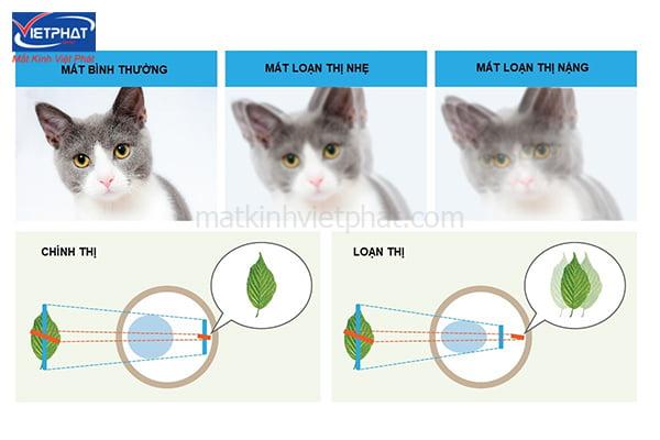 Loạn thị có tăng độ không? Nguyên nhân tăng độ loạn thị 10 nguyên nhân tăng độ loạn thị