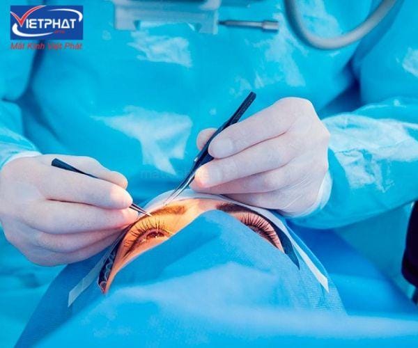 Sạn vôi ở mắt có nguy hiểm không? Cách điều trị và phòng ngừa 9 sạn vôi ở mắt