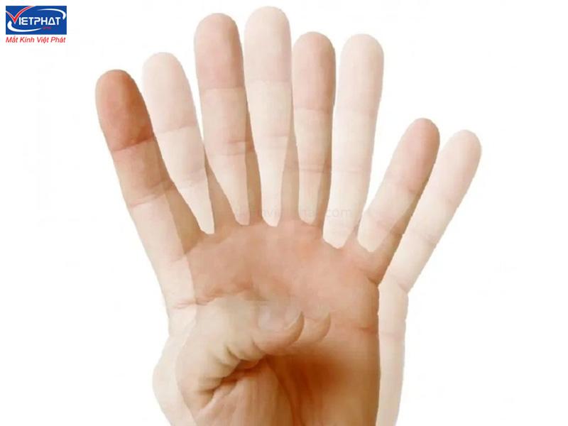 Cách điều trị Song thị - Bệnh nhìn một thành hai 10 Triệu chứng của song thị là gì?