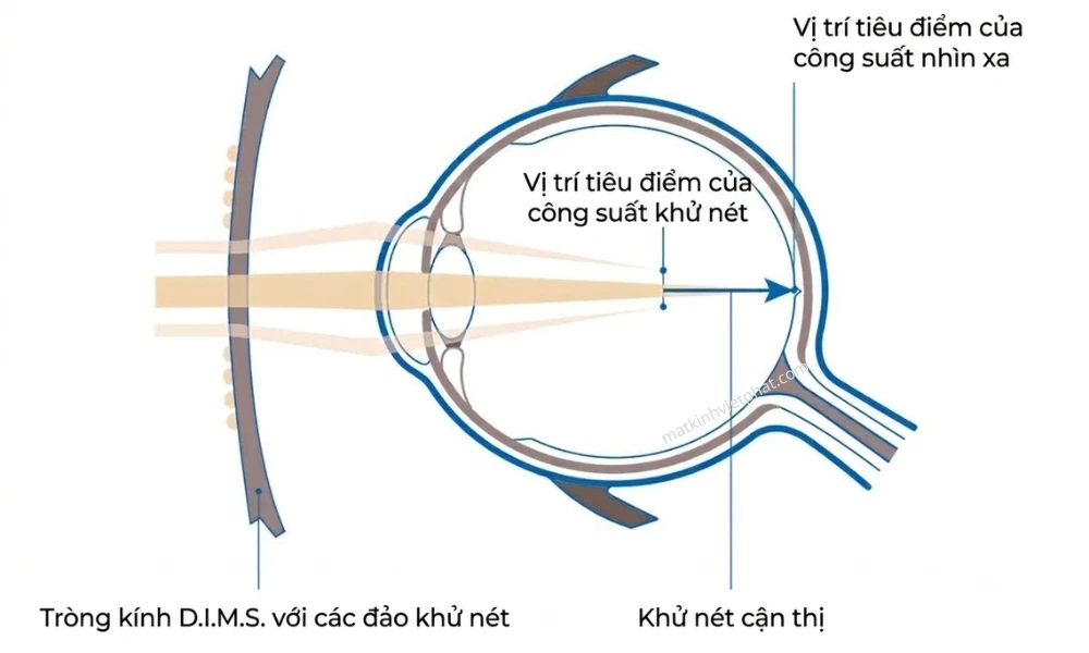 Tròng Kính HOYA MiYOSMART Kiểm Soát Cận Thị Trẻ Em