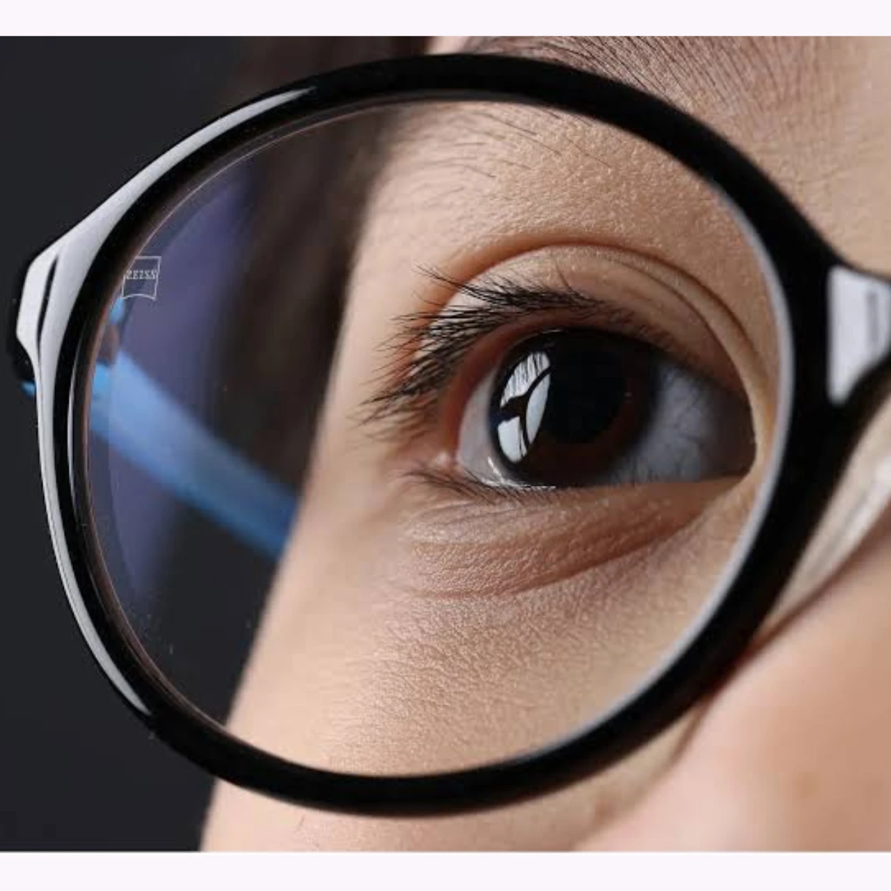 Tròng kính ZEISS MyoEase kiểm soát tiến triển cận thị trẻ em