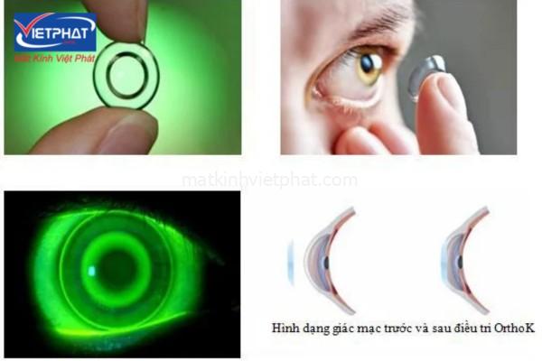 Viễn thị có cần đeo kính không? Bị viễn thị nên đeo kính gì? 13 viễn thị có cần đeo kính không
